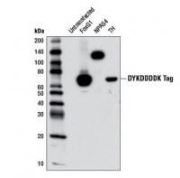 Die wiederholte Geschichte der Western-Blot-Manipulation, diesmal bei Pfizer/BioNTech